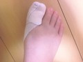 右足の